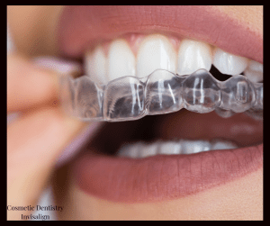 Cosmetic Dentistry - Invisalign