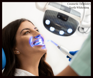 Cosmetic Dentistry - Teeth Whitening