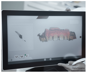 Digital Imaging - Intraoral Camera